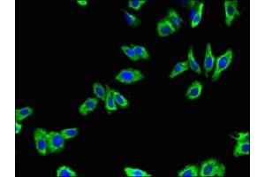 Immunofluorescent analysis of HepG2 cells using ABIN7145355 at dilution of 1:100 and Alexa Fluor 488-congugated AffiniPure Goat Anti-Rabbit IgG(H+L)