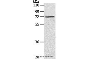 Western blot analysis of TM4 cell, using LTA4H Polyclonal Antibody at dilution of 1:300 (LTA4H anticorps)