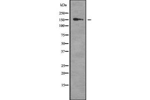 Western blot analysis of Collagen XVI α1 using K562 whole cell lysates