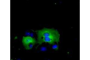 Image no. 3 for anti-Acetyl-CoA Acetyltransferase 2 (ACAT2) antibody (ABIN1496399)