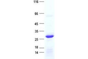 Validation with Western Blot