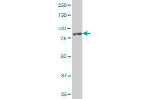 NLGN1 polyclonal antibody (A01), Lot # UTO6060209QCS1 Western Blot analysis of NLGN1 expression in Jurkat