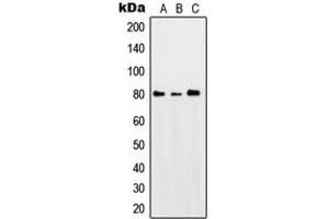 Western blot analysis of PKC theta (pS676) expression in HeLa UV-treated (A), SP2/0 UV-treated (B), PC12 UV-treated (C) whole cell lysates. (PKC theta anticorps  (C-Term, pSer676))