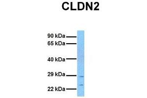 Host:  Rabbit  Target Name:  CLDN2  Sample Tissue:  Human MCF7  Antibody Dilution:  1. (Claudin 2 anticorps  (N-Term))