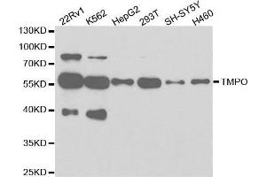Western blot analysis of extracts of various cell lines, using TMPO antibody.