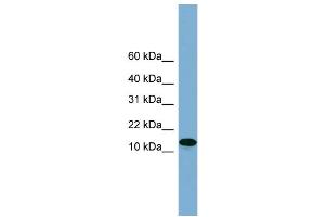 WB Suggested Anti-H2AFX  Antibody Titration: 0. (H2AFX anticorps  (Middle Region))