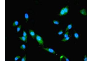 Immunofluorescent analysis of Hela cells using ABIN7170672 at dilution of 1:100 and Alexa Fluor 488-congugated AffiniPure Goat Anti-Rabbit IgG(H+L)