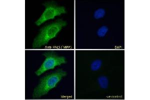 ABIN185150 Immunofluorescence analysis of paraformaldehyde fixed HeLa cells, permeabilized with 0. (MPP5 anticorps  (N-Term))