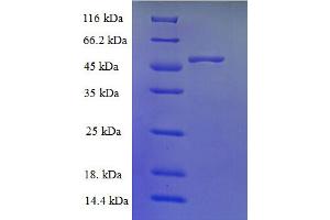 SDS-PAGE (SDS) image for Trimethyllysine Hydroxylase, epsilon (TMLHE) (AA 16-376) protein (His tag) (ABIN5710516)