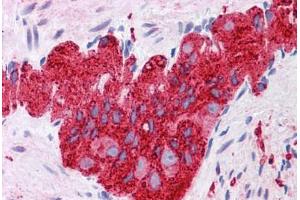 Human Colon, submucosal plexus: Formalin-Fixed, Paraffin-Embedded (FFPE)