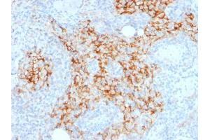 Formalin-fixed, paraffin-embedded human Lymph Node stained with CD14-Monospecific Mouse Monoclonal Antibody (LPSR/2385). (CD14 anticorps  (AA 25-148))