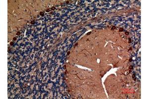 Immunohistochemistry (IHC) analysis of paraffin-embedded Rat Brain, antibody was diluted at 1:100.