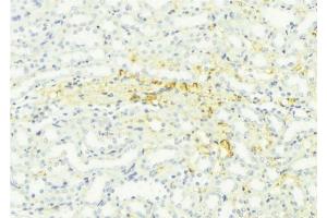 ABIN6276461 at 1/100 staining Mouse kidney tissue by IHC-P. (STAR anticorps  (Internal Region))