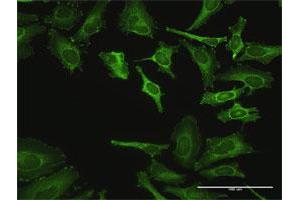 Immunofluorescence of purified MaxPab antibody to ZYX on HeLa cell. (ZYX anticorps  (AA 1-572))