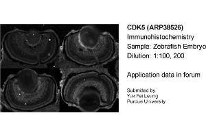 Sample Type: Zebrafish EmbryoDilution: 1:100, 1:200