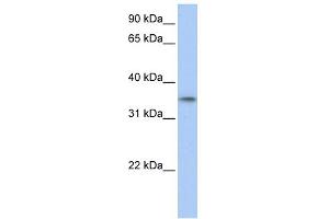 WB Suggested Anti-C17orf39 Antibody Titration: 0. (GID4 anticorps  (C-Term))