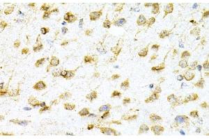 Immunohistochemistry of paraffin-embedded Mouse brain using VAPB Polyclonal Antibody at dilution of 1:200 (40x lens). (VAPB anticorps)