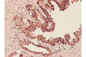 Immunoperoxidase of monoclonal antibody to PHGDH on formalin-fixed paraffin-embedded human prostate.