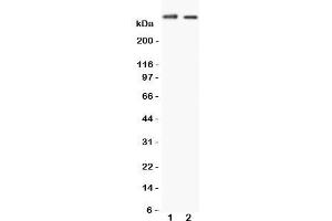 Western blot testing of Huntingtin antibody and Lane 1:  HeLa (Huntingtin anticorps  (C-Term))