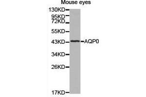 Western Blotting (WB) image for anti-Major Intrinsic Protein of Lens Fiber (MIP) antibody (ABIN1873696) (MIP anticorps)