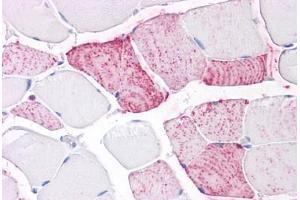 Anti-PTPRA antibody IHC staining of human skeletal muscle.