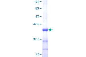 Sonic Hedgehog (SHH) (AA 181-280) protein (GST tag)