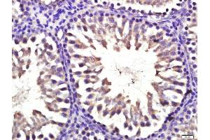 Paraformaldehyde-fixed, paraffin embedded rat testis, Antigen retrieval by boiling in sodium citrate buffer (pH6.