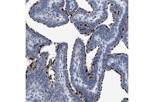 Immunohistochemical staining (Formalin-fixed paraffin-embedded sections) of human fallopian tube with RINT1 polyclonal antibody  shows strong membranous positivity in ciliated glandular cells. (RINT1 anticorps)