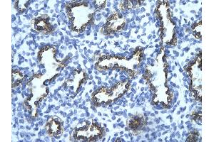 Rabbit Anti-TRIM13 Antibody       Paraffin Embedded Tissue:  Human alveolar cell   Cellular Data:  Epithelial cells of renal tubule  Antibody Concentration:   4.