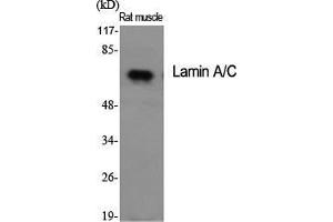 Western Blot (WB) analysis of specific cells using Lamin A/C Polyclonal Antibody. (Lamin A/C anticorps  (Ser78))