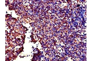 Immunohistochemistry of paraffin-embedded human tonsil tissue using ABIN7153422 at dilution of 1:100 (GALT anticorps  (AA 1-379))