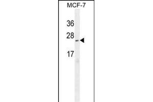 C Antibody (N-term) (ABIN655004 and ABIN2844639) western blot analysis in MCF-7 cell line lysates (35 μg/lane). (CI150 anticorps  (N-Term))