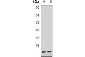 Western blot analysis of AHSP expression in mouse liver (A), rat liver (B) whole cell lysates. (aHSP anticorps)
