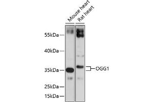 Western blot analysis of extracts of various cell lines, using OGG1 antibody (ABIN3021936, ABIN3021937, ABIN3021938 and ABIN6217976) at 1:1000 dilution. (OGG1 anticorps  (AA 1-345))