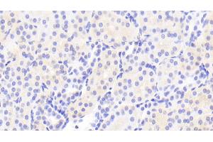 Detection of TIMP4 in Human Kidney Tissue using Polyclonal Antibody to Tissue Inhibitors Of Metalloproteinase 4 (TIMP4)