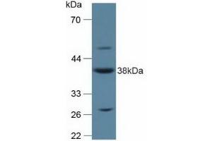 Detection of ANXA2 in Rat Placenta Tissue using Polyclonal Antibody to Annexin A2 (ANXA2) (Annexin A2 anticorps  (AA 1-339))