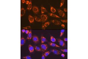 Immunofluorescence analysis of NIH-3T3 cells using Smac/Diablo Rabbit mAb (ABIN7270177) at dilution of 1:100 (40x lens). (DIABLO anticorps)