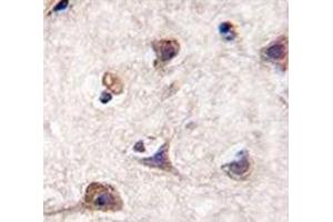 IHC analysis of FFPE human brain tissue stained with LC3 antibody