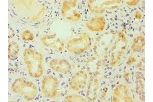 Immunohistochemistry of paraffin-embedded human kidney tissue using ABIN7170761 at dilution of 1:100