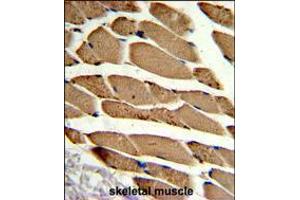 Formalin-fixed and paraffin-embedded human skeletal muscle reacted with ACTR2 Antibody , which was peroxidase-conjugated to the secondary antibody, followed by DAB staining. (ACTR2 anticorps  (AA 191-219))