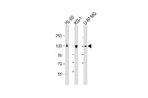 Western Blot at 1:2000 dilution Lane 1: HL-60 whole cell lysate Lane 2: KG-1 whole cell lysate Lane 3: U-87 MG whole cell lysate Lysates/proteins at 20 ug per lane. (DEPDC5 anticorps  (C-Term))