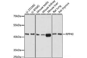 Western blot analysis of extracts of various cell lines using RPP40 Polyclonal Antibody at dilution of 1:1000.