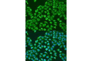 Immunofluorescence analysis of U2OS cells using Pumilio 1 antibody  at dilution of 1:100.