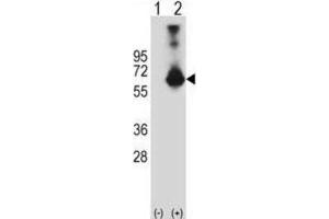 Western Blotting (WB) image for anti-Cystathionine-beta-Synthase (CBS) antibody (ABIN3002903)