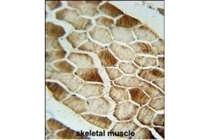 SAR1B antibody (Center) (ABIN654355 and ABIN2844120) immunohistochemistry analysis in formalin fixed and paraffin embedded human skeletal muscle followed by peroxidase conjugation of the secondary antibody and DAB staining.