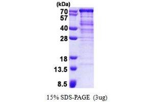 SDS-PAGE (SDS) image for Alveolar Soft Part Sarcoma Chromosome Region, Candidate 1 (ASPSCR1) (AA 1-553) protein (His tag) (ABIN6387221)