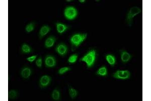 Immunofluorescence staining of A549 cells with ABIN7176339 at 1:166, counter-stained with DAPI.