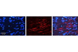 Rabbit Anti-INSR Antibody   Formalin Fixed Paraffin Embedded Tissue: Human Ovary Tissue Observed Staining: Plasma membrane Primary Antibody Concentration: 1:100 Other Working Concentrations: N/A Secondary Antibody: Donkey anti-Rabbit-Cy3 Secondary Antibody Concentration: 1:200 Magnification: 20X Exposure Time: 0.