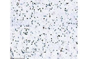 IHC analysis of ADAR1/ADAR using anti-ADAR1/ADAR antibody (ABIN7598956). (ADAR anticorps  (AA 1-1152))