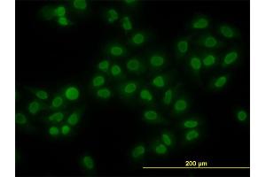 Immunofluorescence of monoclonal antibody to HMGB1 on HeLa cell. (HMGB1 anticorps  (AA 1-90))